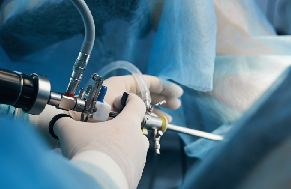 artoscopia_Mesa de trabajo 1