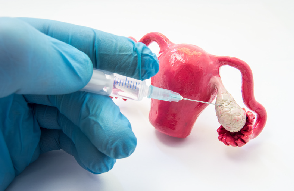 ovarica_Mesa de trabajo 1